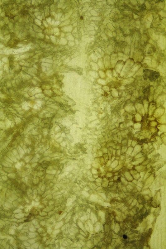 Datei:Dry blood under a microscope 4 (cropped).jpg - Wikipedia