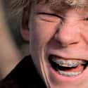 Scut Farkus Sports A Type Of Braces That Weren’t Invented Until The '70s  on Random Inaccuracy In 'A Christmas Story’s Version Of '40s
