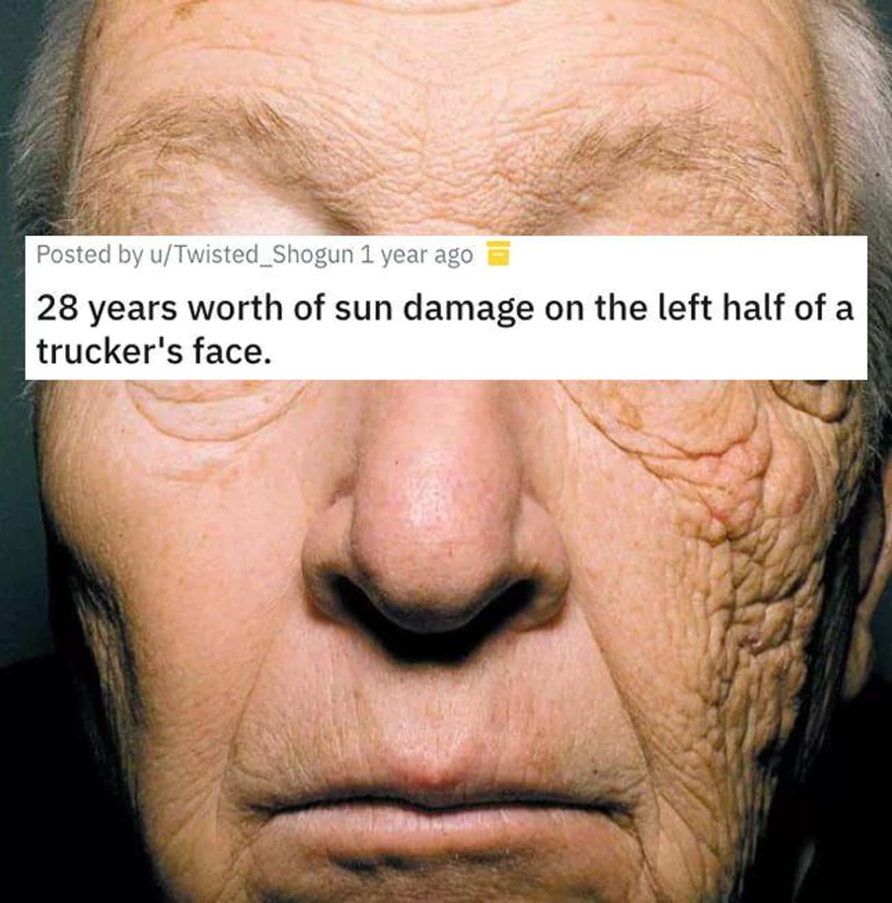 Sun Damage Is Real