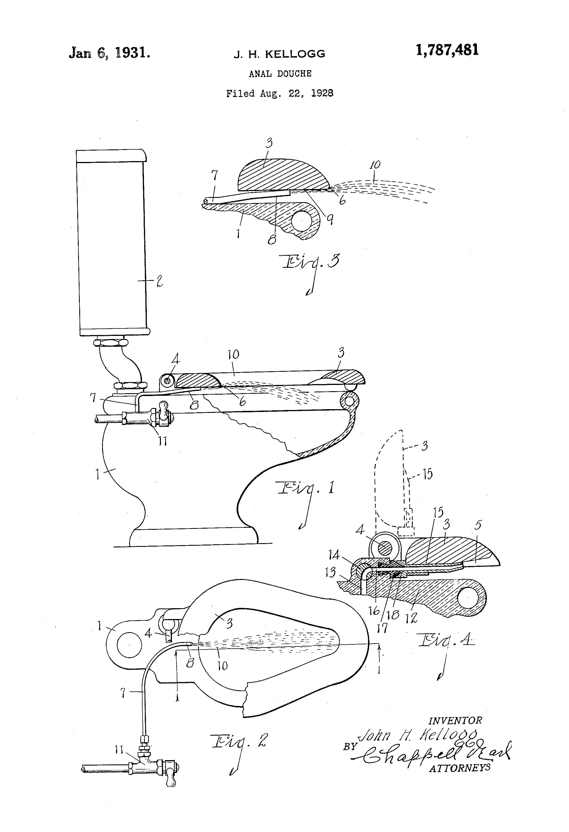 Why Are Bidets So Popular In Other Countries But Not The US?