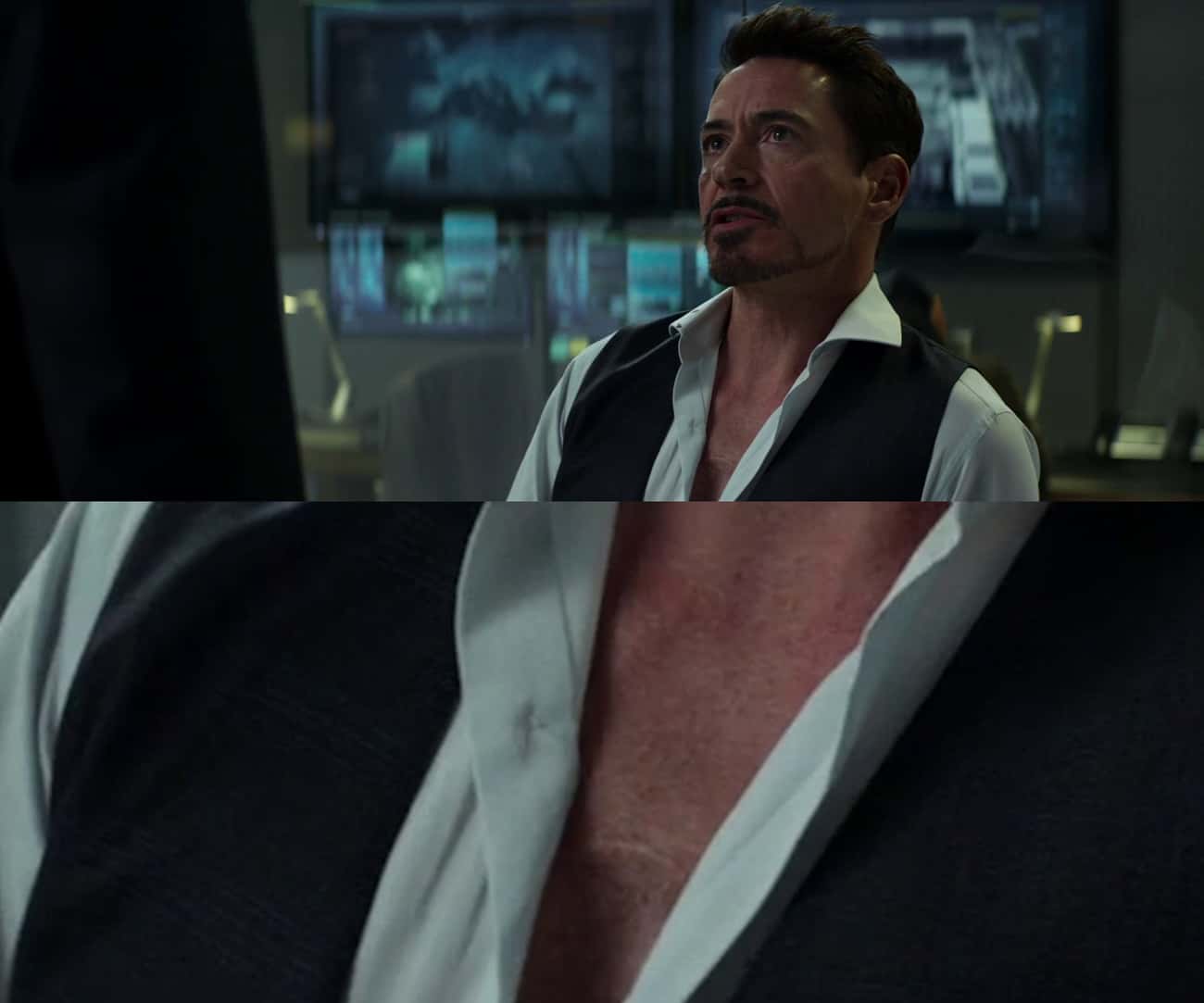 Tony's Scars Are Visible