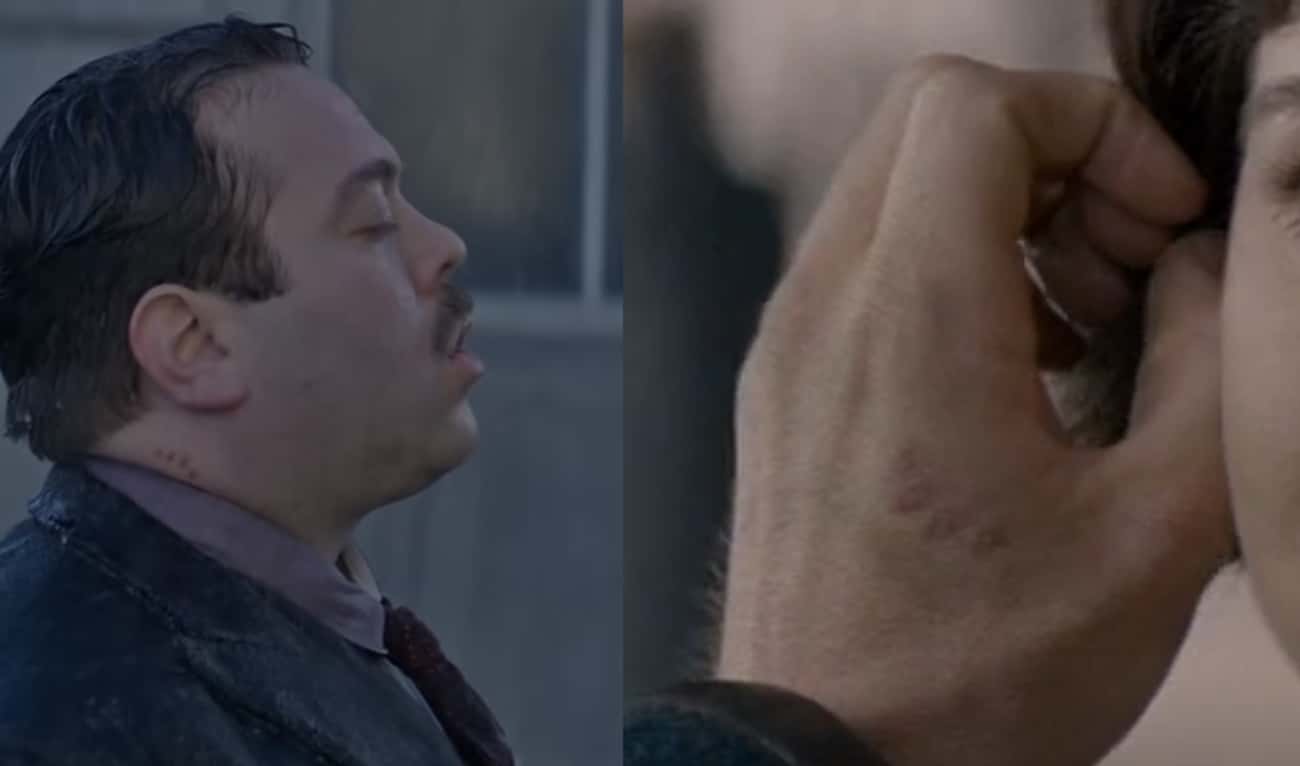 Newt Has A Scarred Over Murtlap Wound On His Hand
