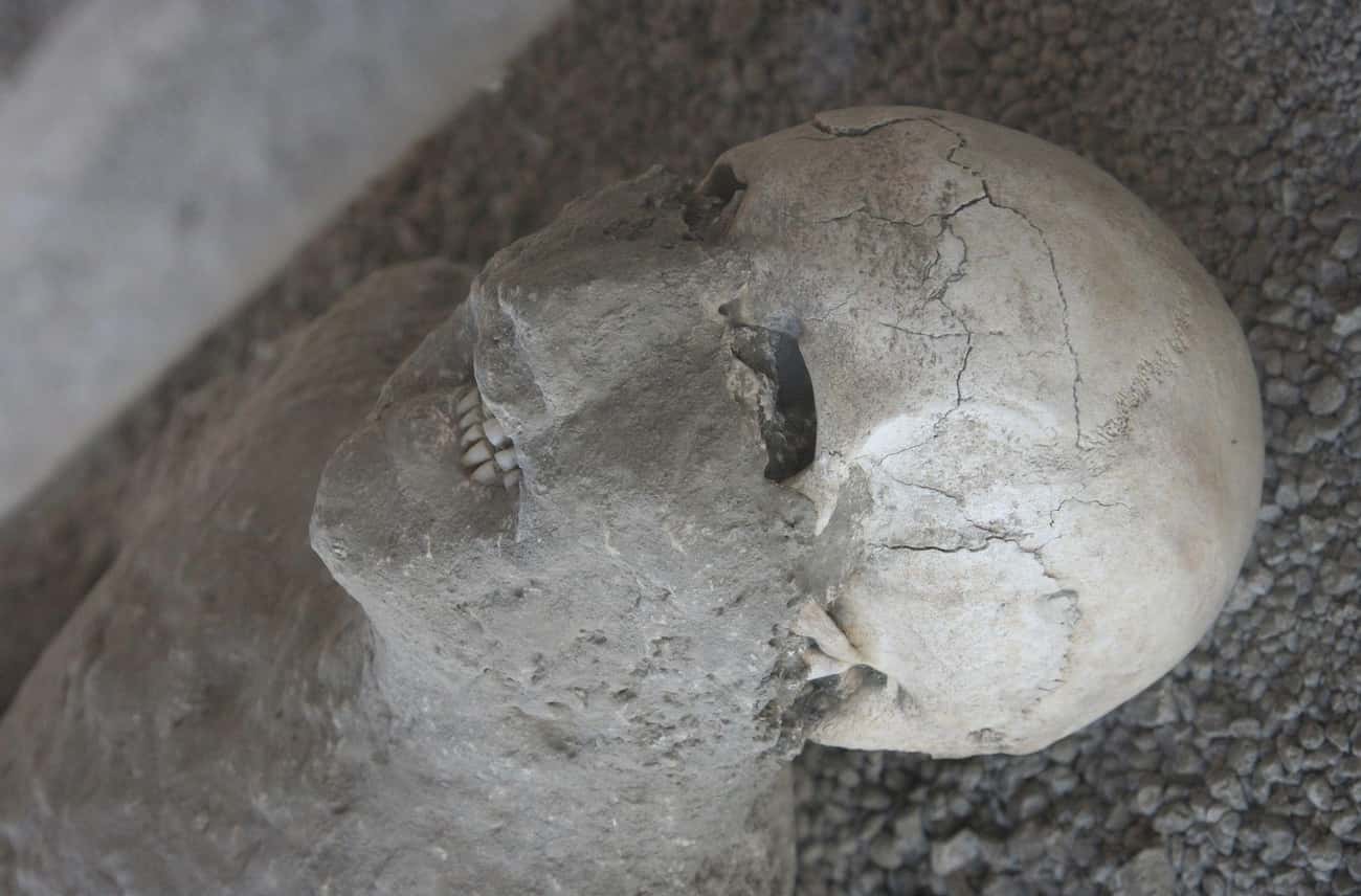 Unlike Other Romans, Pompeiians Had Nearly Perfect Teeth