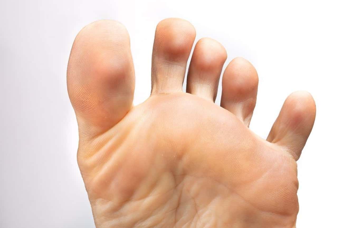 Toe Cheese Is Real, And People Are Growing More Of It