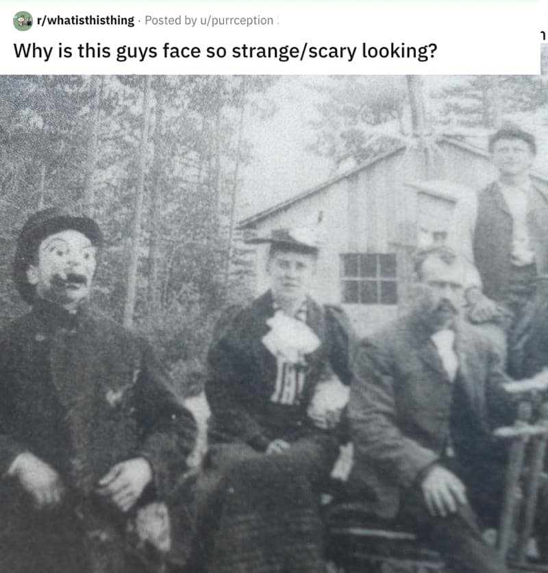 Why Is This Gentleman Wearing A Mask? What Is Its Purpose?