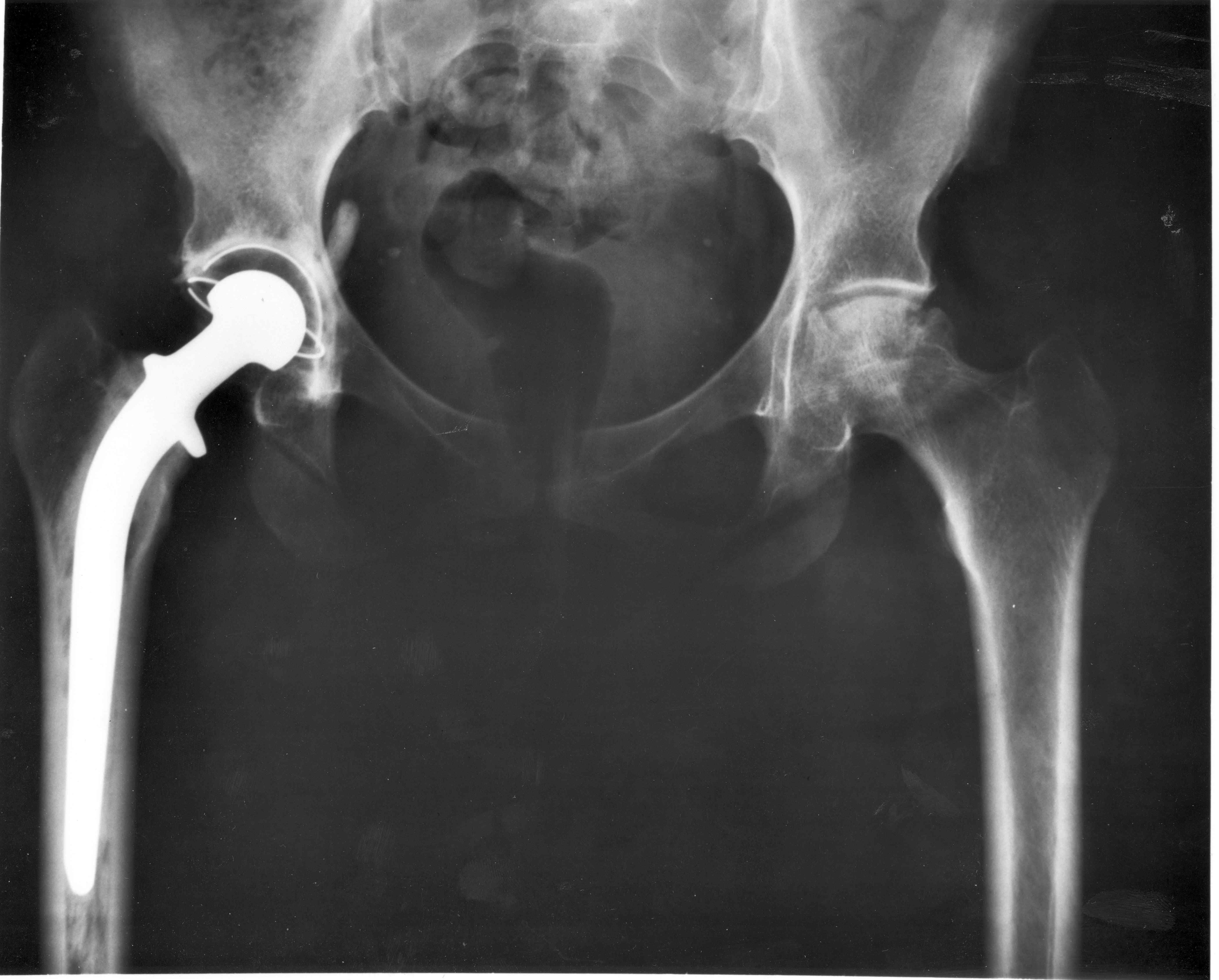 History's Most Impressive Firsts In Surgery And Medicine
