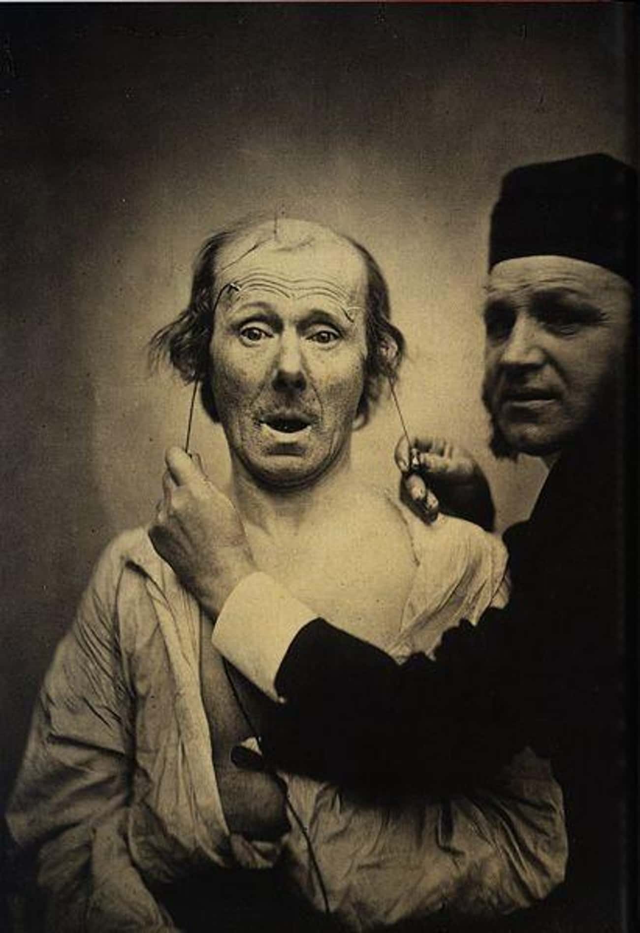 Mid-19th Century: Facial Electrostimulus Experiment Photos By Guillaume Duchenne 
