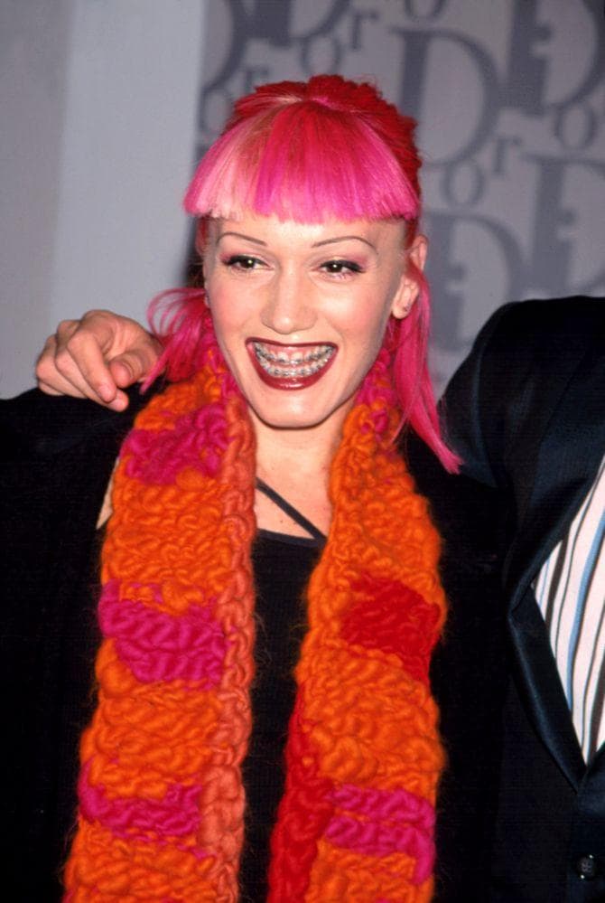 Famous People with Braces Celebs Who Had Braces (Page 2)