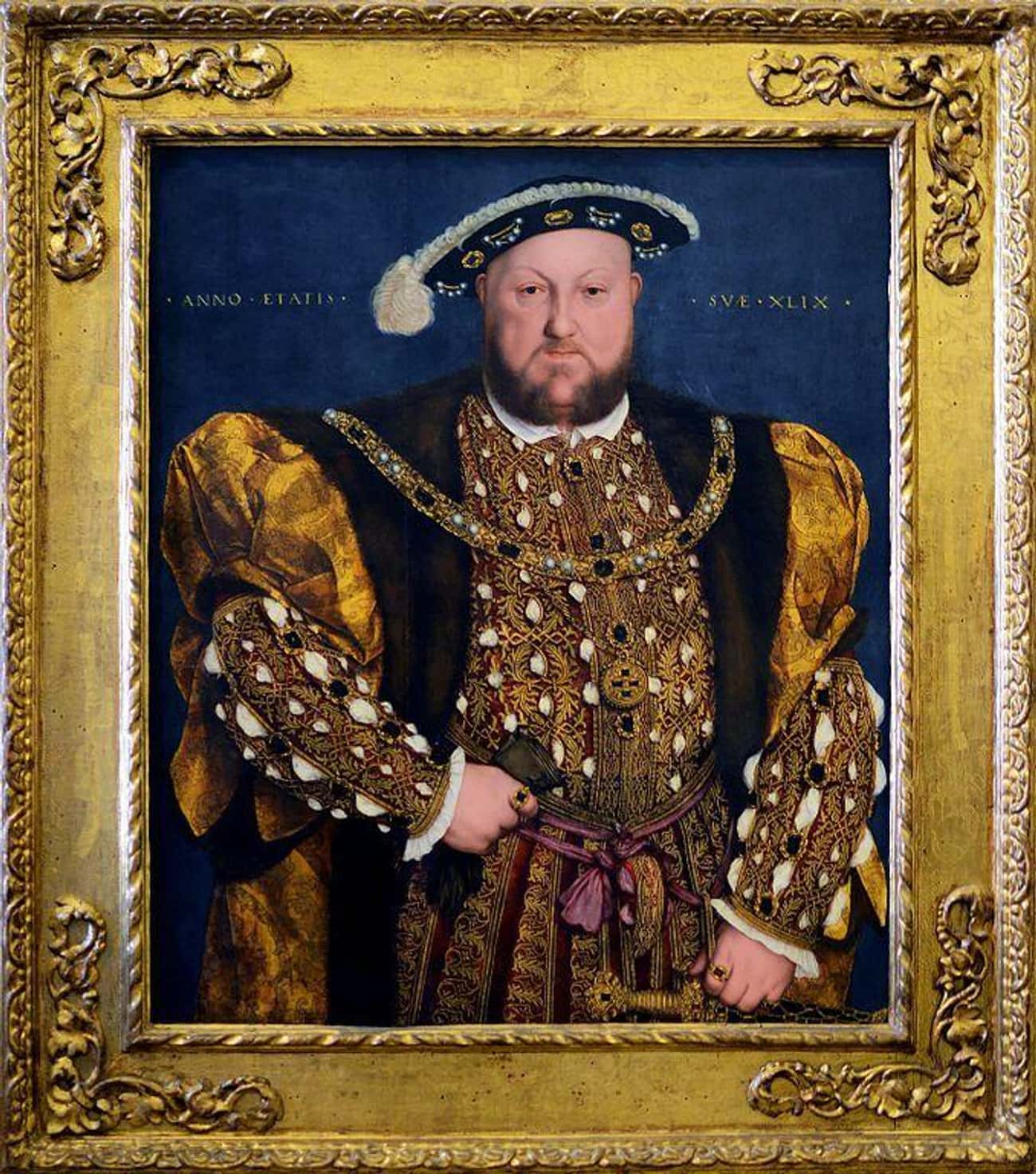 Henry VIII of England Is The Poster Child For Gout