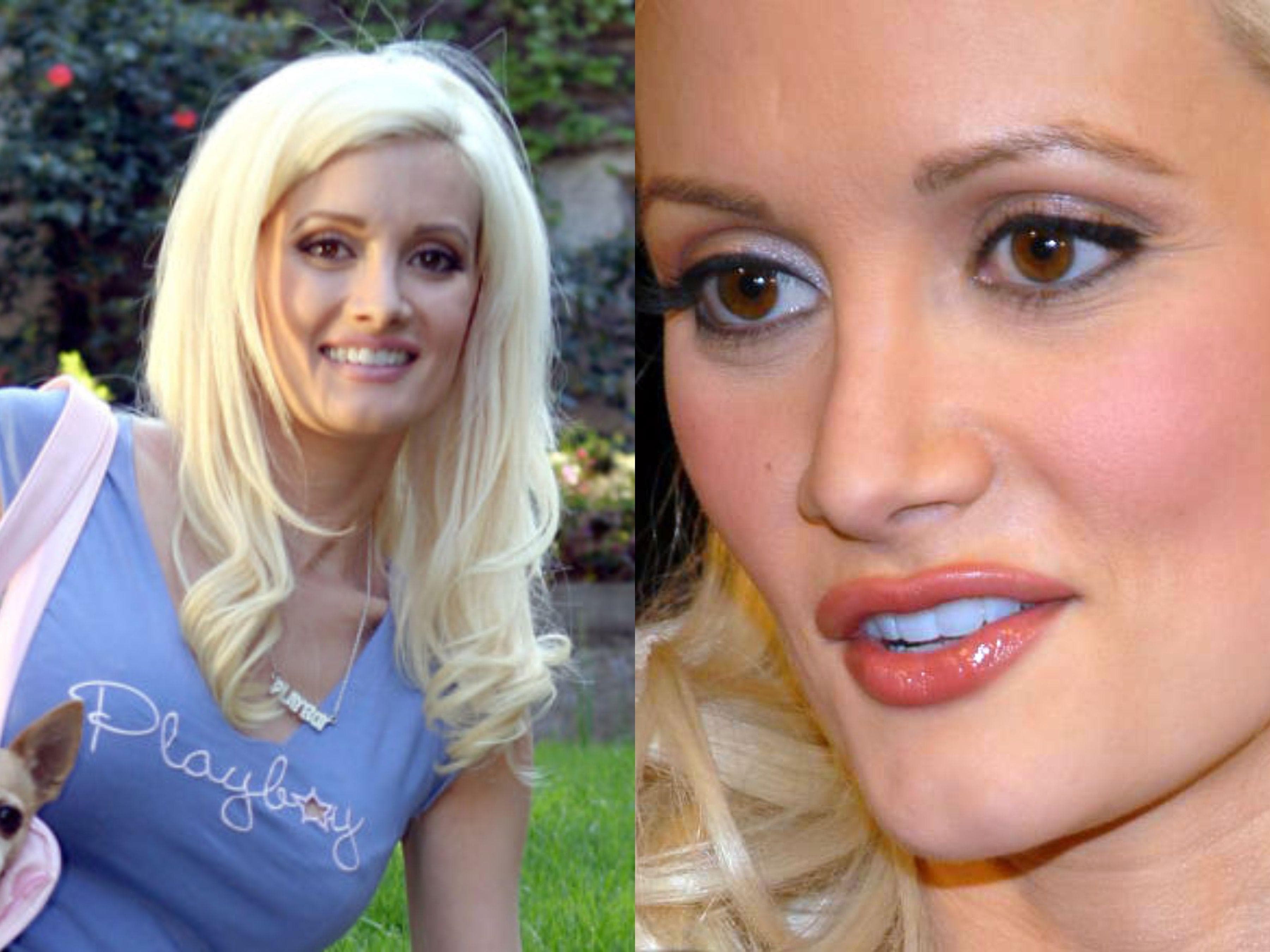 Celebrity Nose Jobs: Before And After