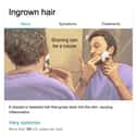 Ingrown hair on Random Weird Medical Drawings Google Thinks You Need