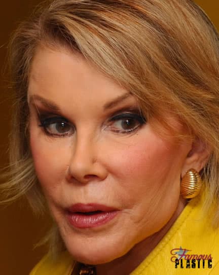 Addicted To Plastic Surgery 12 Biggest Plastic Surgery Addicts