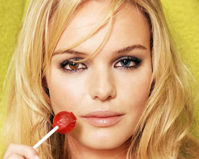 Kate Bosworth is listed (or ranked) 9 on the list Celebrities with Birth Defects