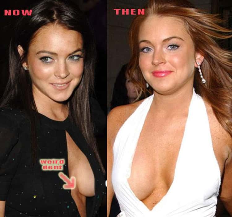 7 of the World's Best Breasts: Beautiful Celebrity Breast Jobs 