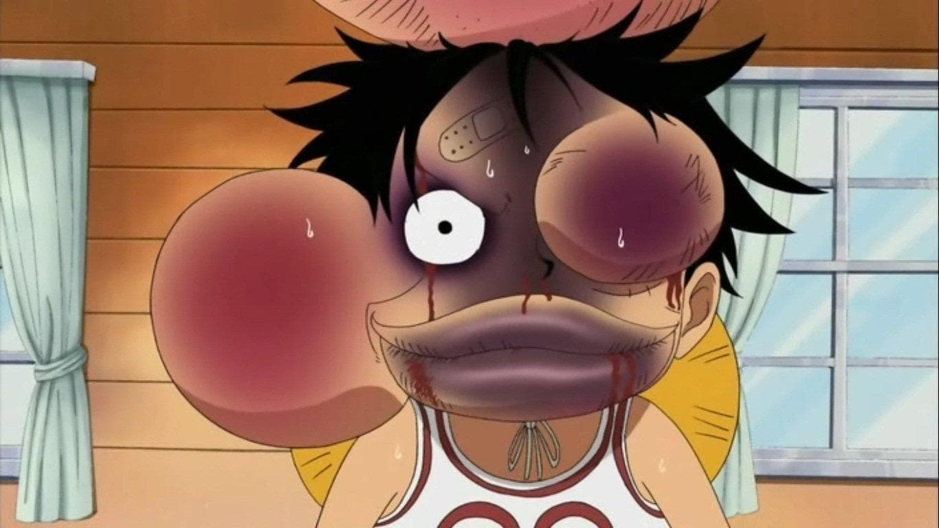 The 15 Worst Injuries Luffy Has Suffered in One Piece