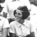 Rosemary Kennedy on Random Twisted Before & After Stories Of Lobotomy Victims